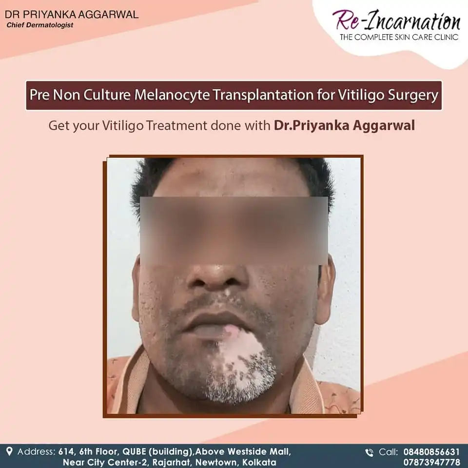 Dermatologist in Bangladesh 242416431_397909878366939_1743694962624433476_n