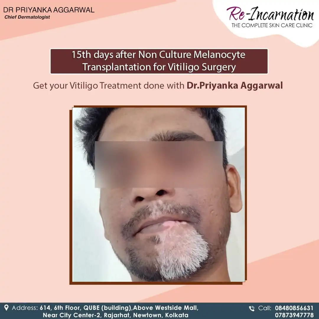 Dermatologist in Bangladesh 242582385_397910025033591_1394494262146567188_n