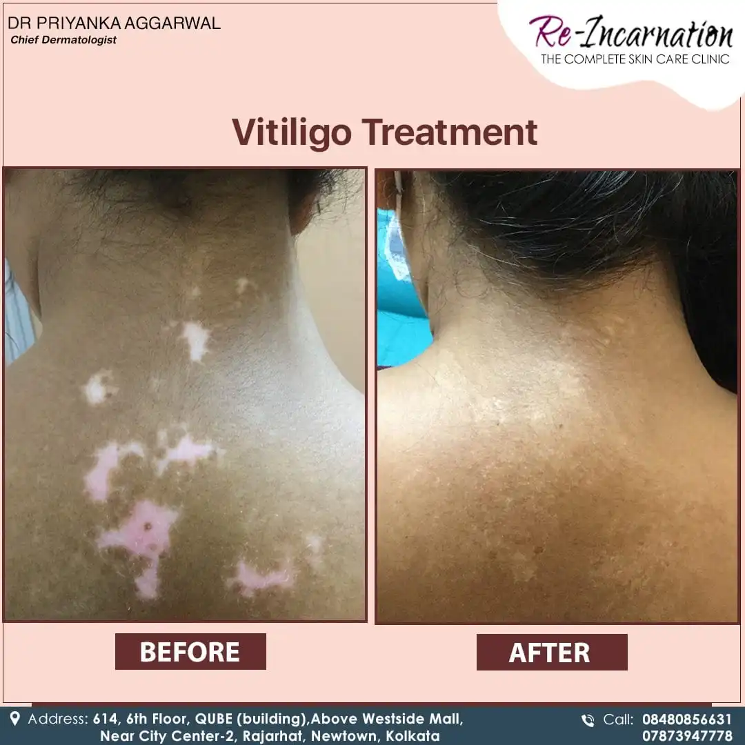 Dermatologist in Bangladesh 271888221_468312201326706_278549398357518012_n (1)