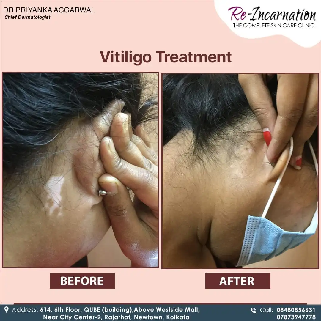 Dermatologist in Bangladesh 271898599_468312081326718_2290401922967744013_n (1)