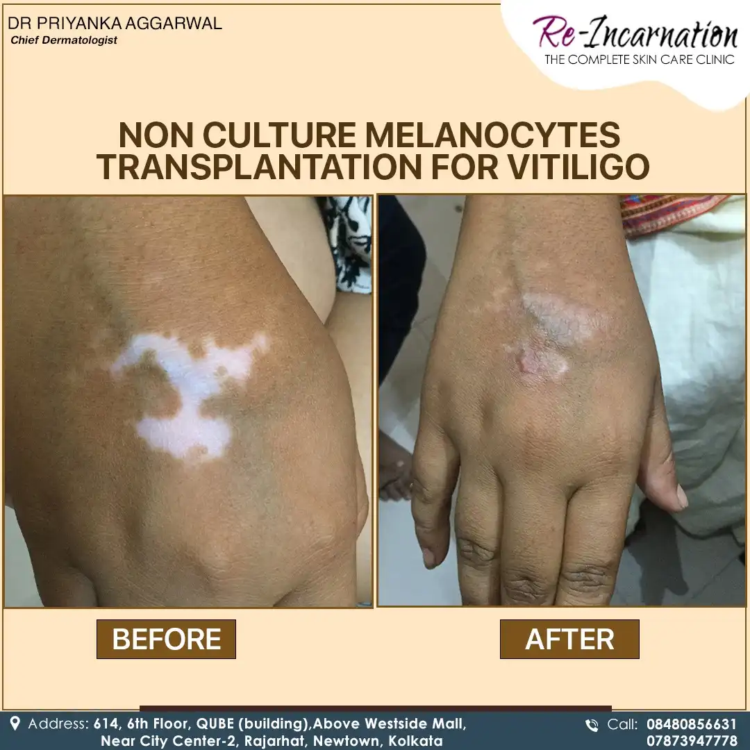 Dermatologist in Bangladesh 315286098_501899365332926_5983358918962540685_n