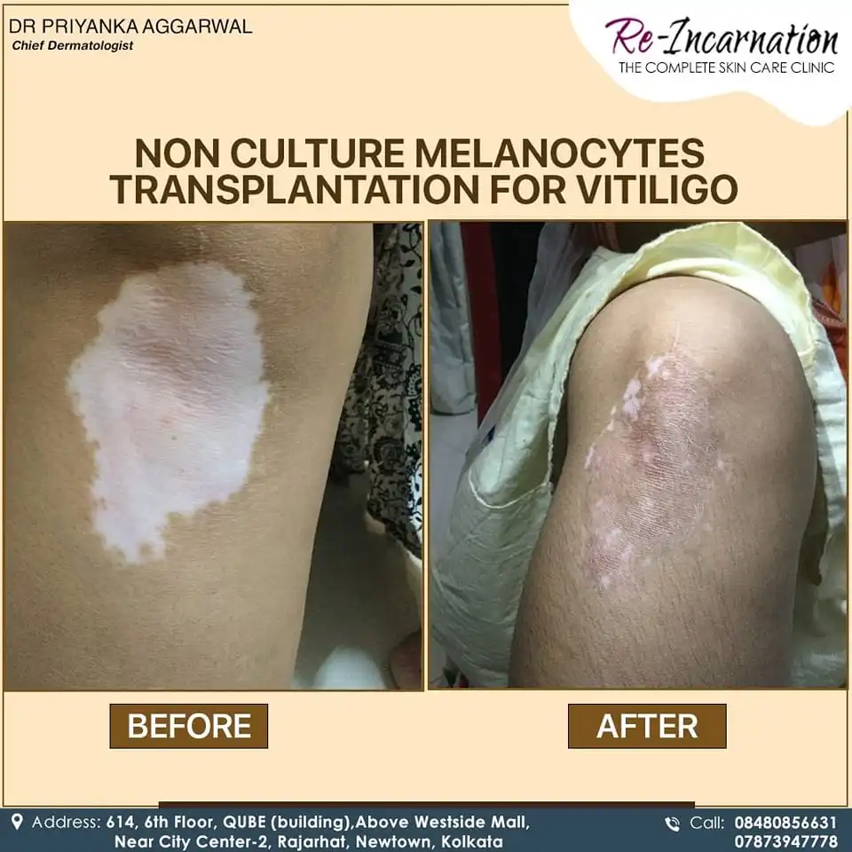 Dermatologist in Bangladesh 315883613_507026404820222_5365006138971088775_n