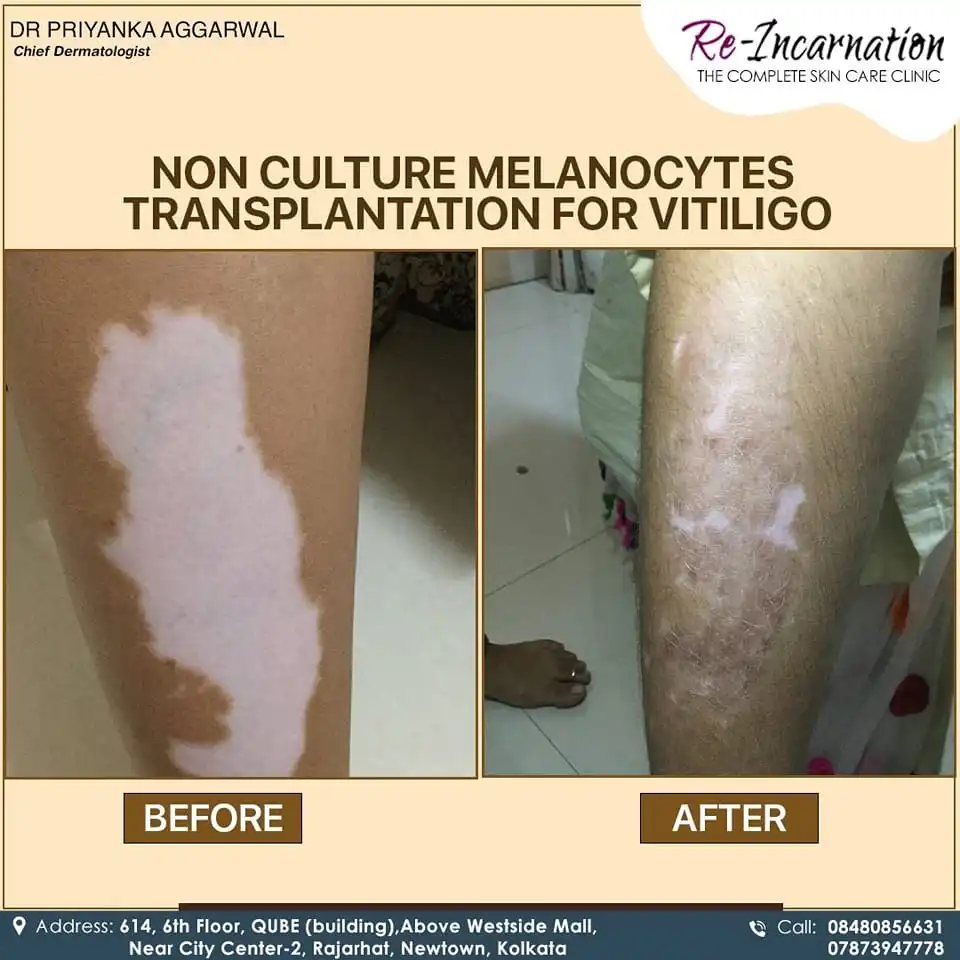 Dermatologist in Bangladesh 315986481_507731454749717_1036138720151748273_n