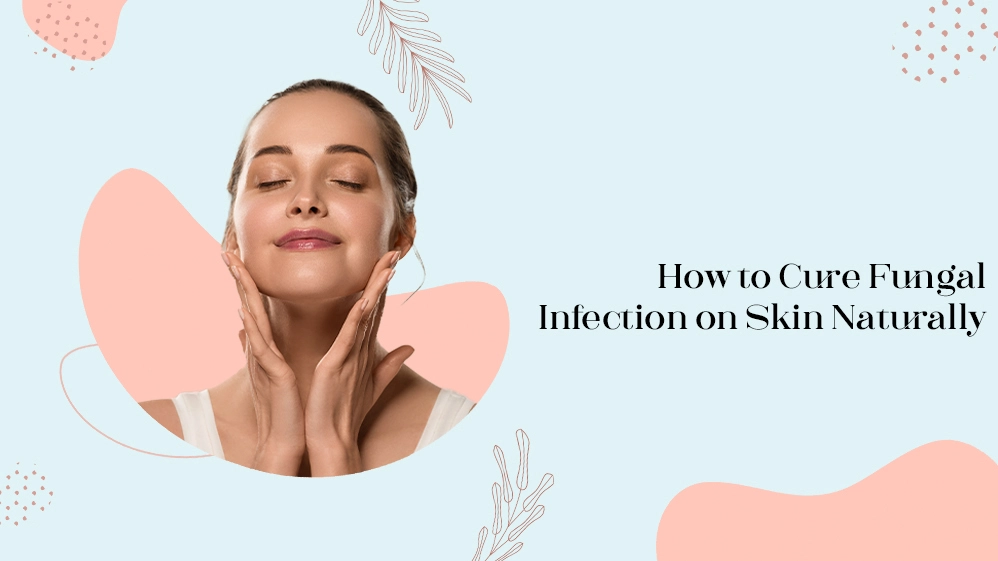 how to cure fungal infection on the skin naturally